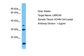 LRRC46 Rabbit Polyclonal Antibody