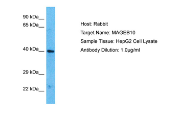 MAGEB10 Rabbit Polyclonal Antibody