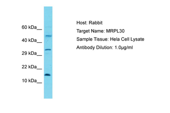 MRPL30 Rabbit Polyclonal Antibody