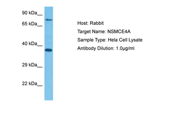 NSMCE4A Rabbit Polyclonal Antibody
