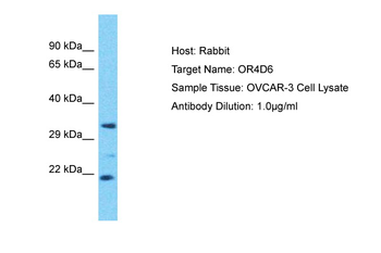 OR4D6 Rabbit Polyclonal Antibody