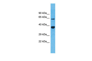 OR5D13 Rabbit Polyclonal Antibody