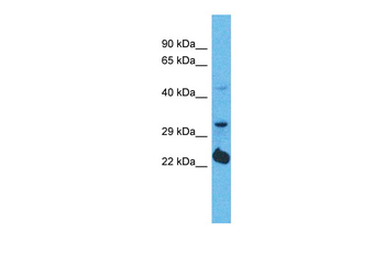 OR5D14 Rabbit Polyclonal Antibody