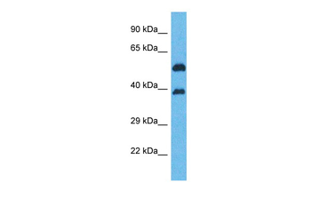 OR5K2 Rabbit Polyclonal Antibody