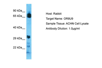OR8U9 Rabbit Polyclonal Antibody