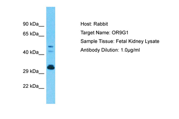 OR9G1 Rabbit Polyclonal Antibody