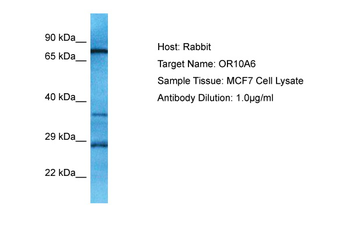 OR10A6 Rabbit Polyclonal Antibody