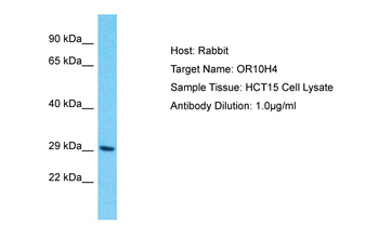 OR10H4 Rabbit Polyclonal Antibody