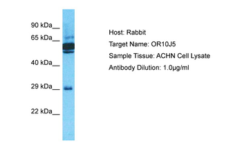 OR10J5 Rabbit Polyclonal Antibody