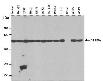 OTUD1 Rabbit Polyclonal Antibody