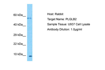 PLGLB2 Rabbit Polyclonal Antibody