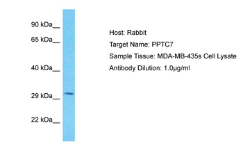 PPTC7 Rabbit Polyclonal Antibody