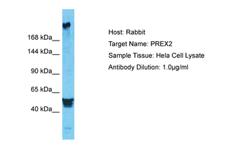 PREX2 Rabbit Polyclonal Antibody