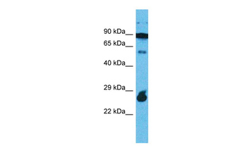 RAPGEFL1 Rabbit Polyclonal Antibody