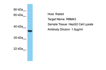 RBM43 Rabbit Polyclonal Antibody