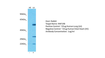 RNF19B Rabbit Polyclonal Antibody