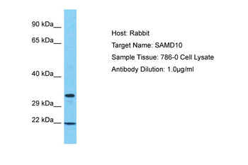 SAMD10 Rabbit Polyclonal Antibody