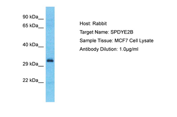 SPDYE2B Rabbit Polyclonal Antibody