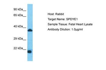 SPDYE1 Rabbit Polyclonal Antibody