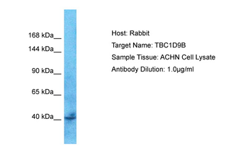 TBC1D9B Rabbit Polyclonal Antibody