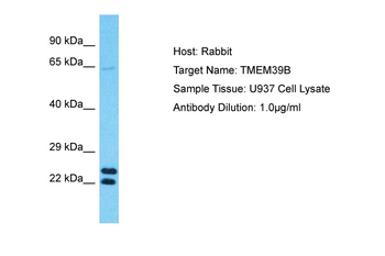 TMEM39B Rabbit Polyclonal Antibody