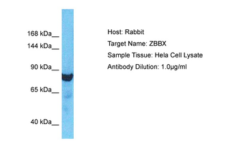 ZBBX Rabbit Polyclonal Antibody
