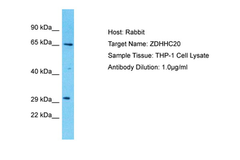 ZDHHC20 Rabbit Polyclonal Antibody