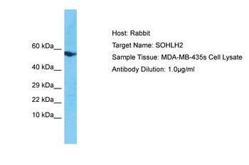 SOHLH2 Rabbit Polyclonal Antibody