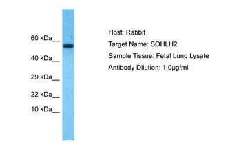 SOHLH2 Rabbit Polyclonal Antibody