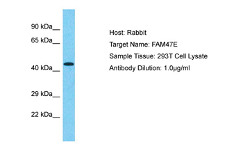 FAM47E Rabbit Polyclonal Antibody
