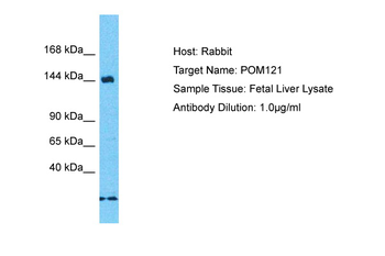 POM121 Rabbit Polyclonal Antibody