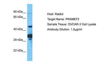 PRAMEF2 Rabbit Polyclonal Antibody