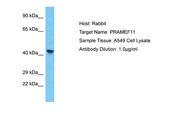 PRAMEF11 Rabbit Polyclonal Antibody