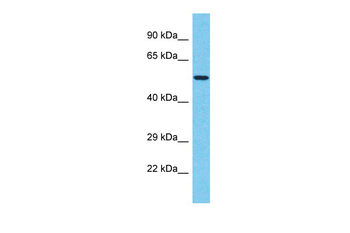 TBX20 Rabbit Polyclonal Antibody