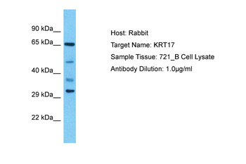 KRT17 Rabbit Polyclonal Antibody
