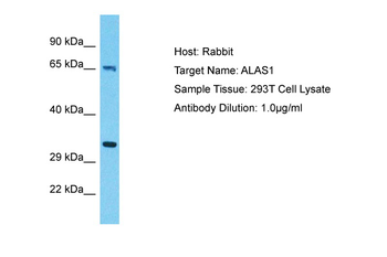 ALAS1 Rabbit Polyclonal Antibody