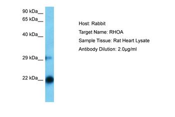 RHOA Rabbit Polyclonal Antibody