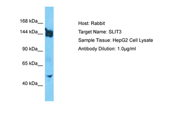 SLIT3 Rabbit Polyclonal Antibody