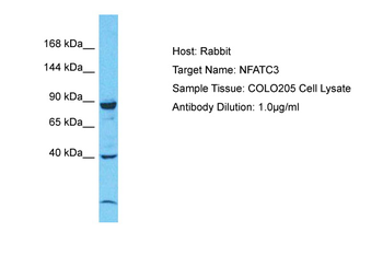 NFATC3 Rabbit Polyclonal Antibody