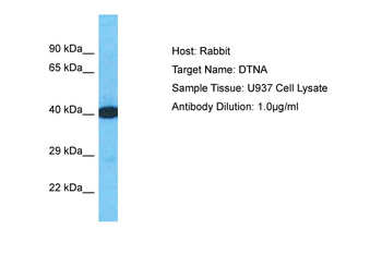 DTNA Rabbit Polyclonal Antibody