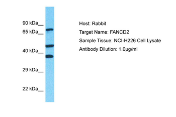 FANCD2 Rabbit Polyclonal Antibody