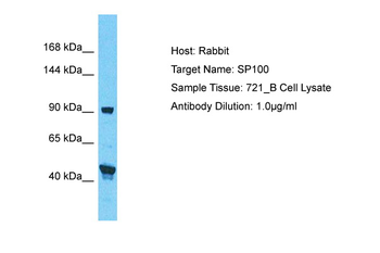 SP100 Rabbit Polyclonal Antibody