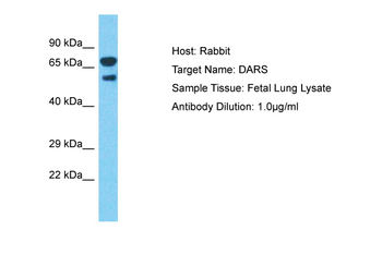 DARS Rabbit Polyclonal Antibody