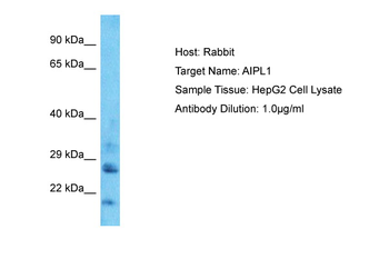 AIPL1 Rabbit Polyclonal Antibody