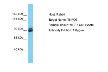 TNPO3 Rabbit Polyclonal Antibody