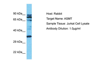 ASMT Rabbit Polyclonal Antibody