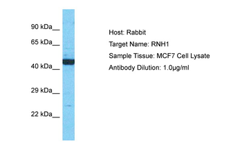RNH1 Rabbit Polyclonal Antibody