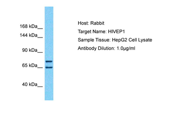 HIVEP1 Rabbit Polyclonal Antibody