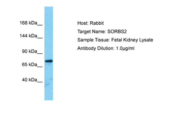 SORBS2 Rabbit Polyclonal Antibody