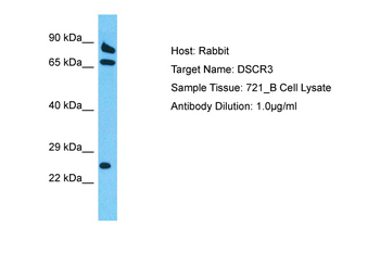 VPS26C Rabbit Polyclonal Antibody